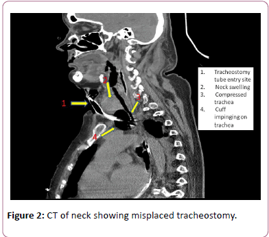 emergency-internal-medicine-misplaced