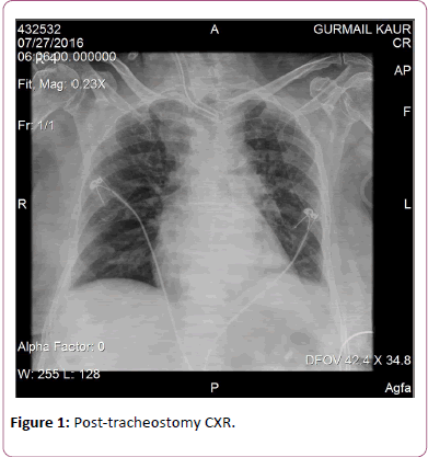 emergency-internal-medicine-tracheostomy