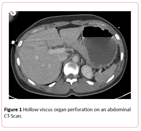 emergency-trauma-care-Hollow-viscus-organ