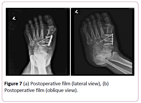 emergency-trauma-care-Postoperative