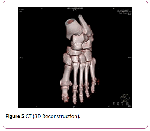 emergency-trauma-care-Reconstruction