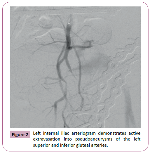 emergency-trauma-care-arteriogram