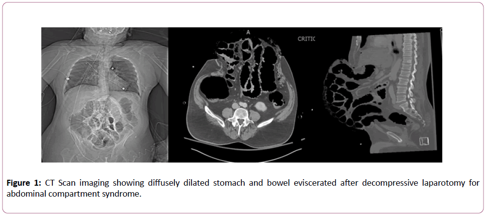 emergency-trauma-care-dilated-stomach