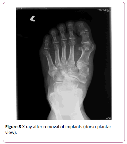 emergency-trauma-care-dorso-plantar