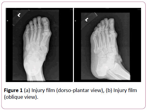 emergency-trauma-care-dorso-plantar-view