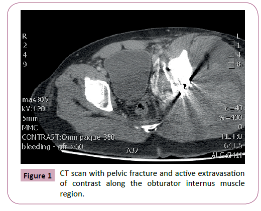 emergency-trauma-care-fracture