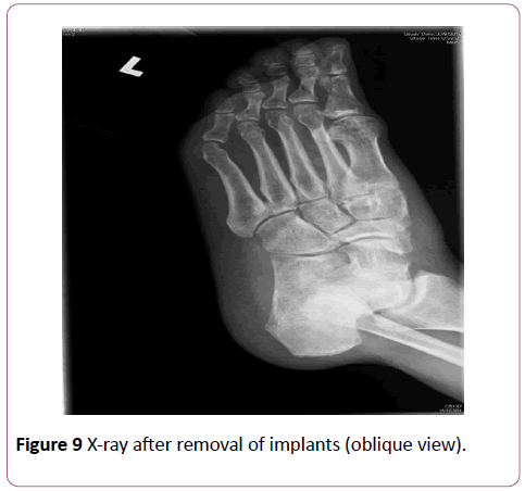 emergency-trauma-care-implants-oblique