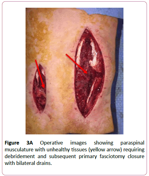 emergency-trauma-care-musculature