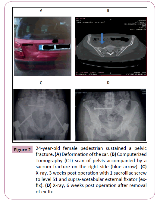 emergency-trauma-care-pedestrian