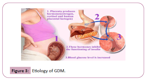 endocrinology-metabolism-Etiology