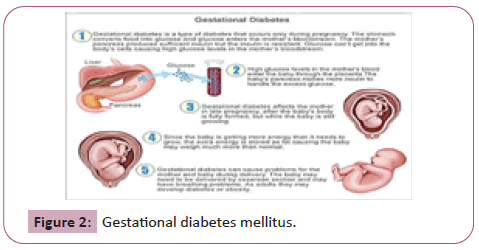 endocrinology-metabolism-mellitus