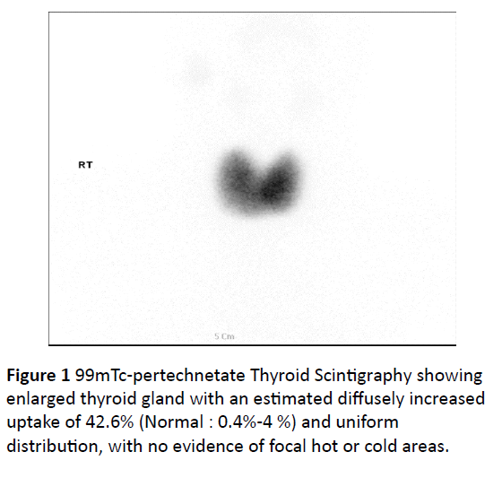 endocrinology-research-thyroid-scintigraphy