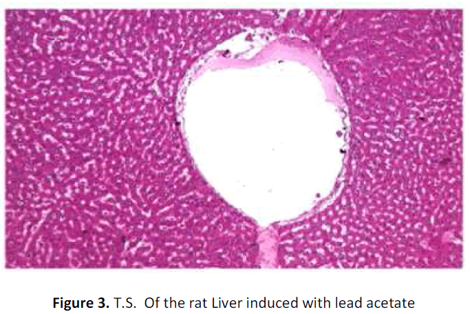 ethnomedicine-liver-induced-lead
