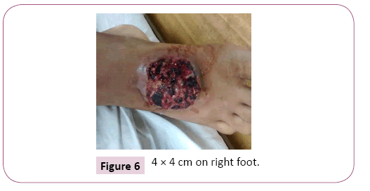 ethnomedicine-right