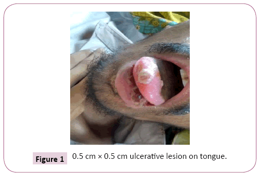 ethnomedicine-ulcerative