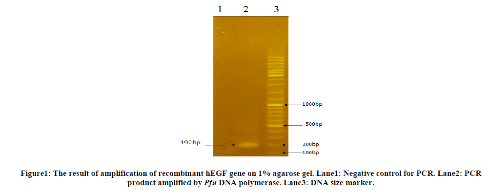 Purification and biological activity assessment: Comparison between two