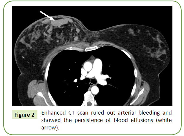 general-surgery-reports-arterial-bleeding