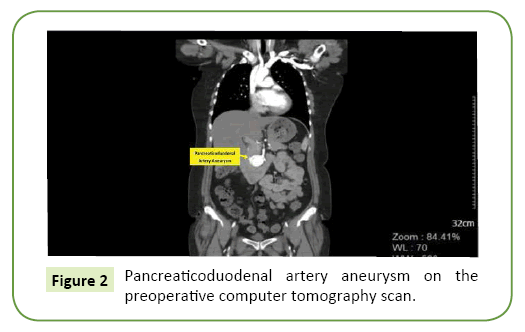 general-surgery-reports-artery