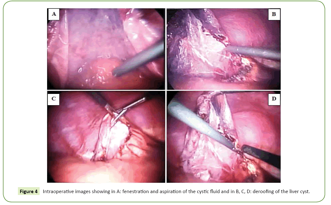 general-surgery-reports-deroofing