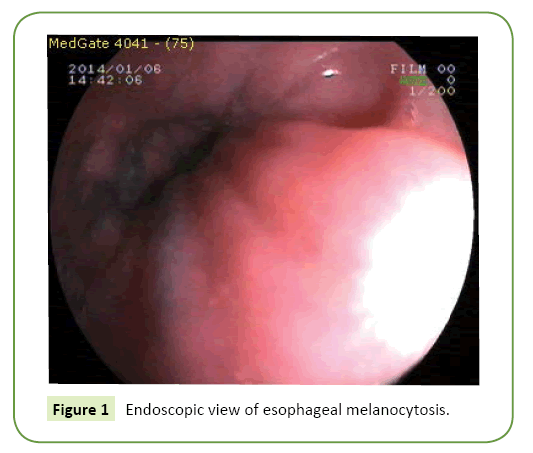 general-surgery-reports-esophageal