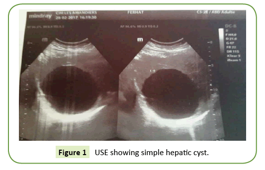 general-surgery-reports-hepatic