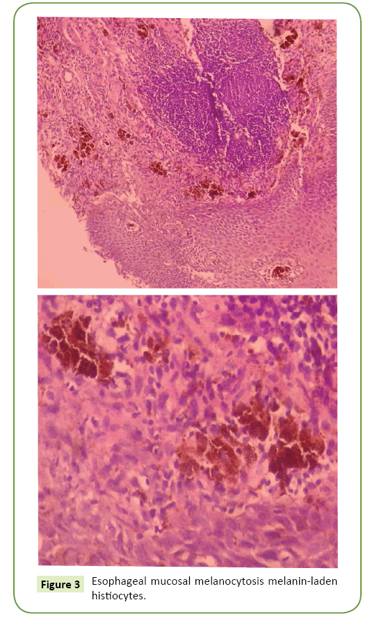 general-surgery-reports-histiocytes