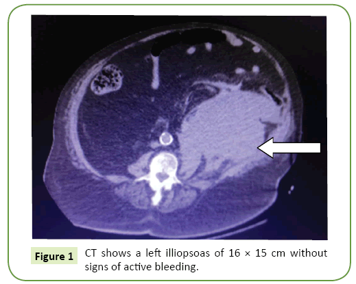 general-surgery-reports-illiopsoas