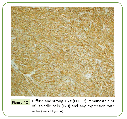 general-surgery-reports-immunostaining