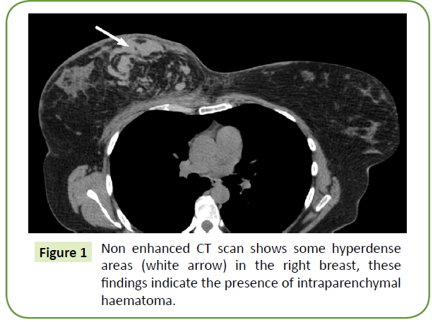 general-surgery-reports-intraparenchymal