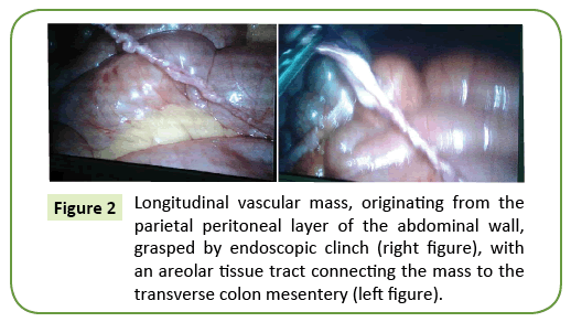 general-surgery-reports-peritoneal