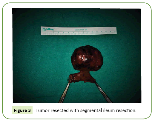 general-surgery-reports-resection