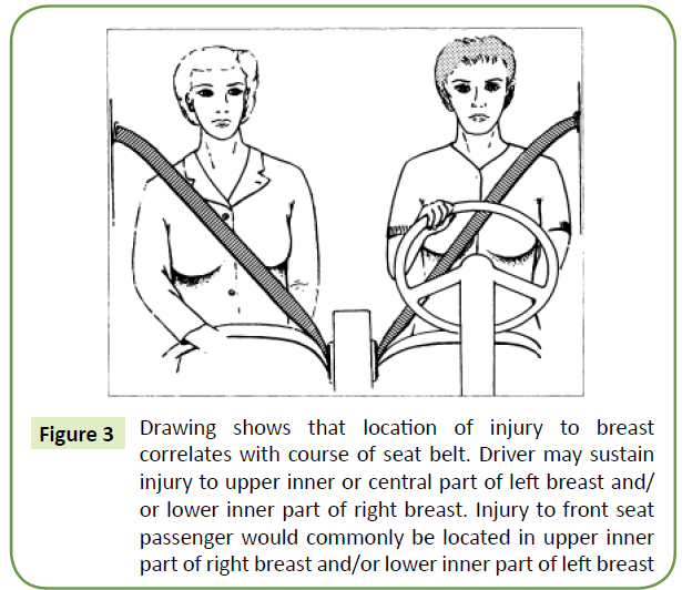 general-surgery-reports-right-breast