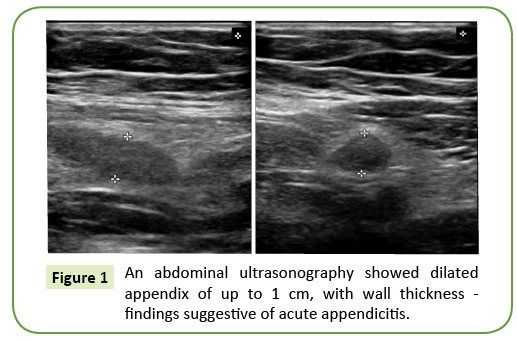 general-surgery-reports-ultrasonography