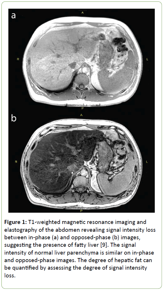 genetic-disorders-magnetic-resonance