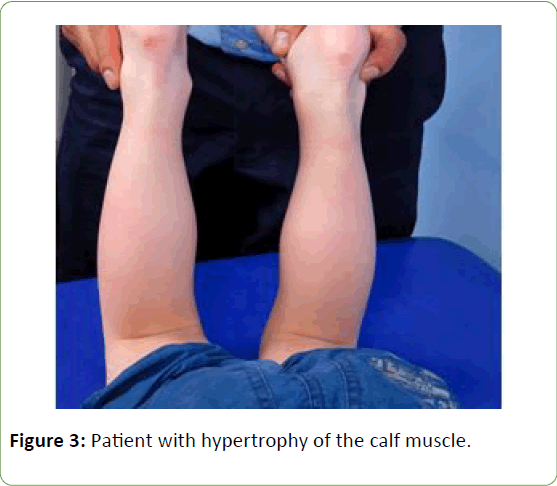 genetics-molecular-biology-calf-muscle