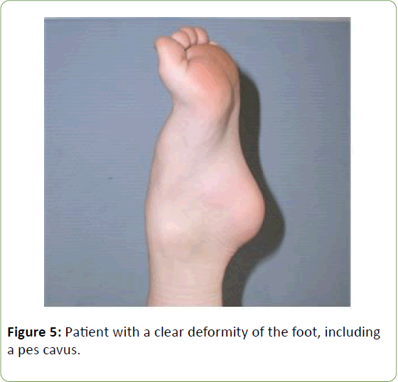 genetics-molecular-biology-clear-deformity