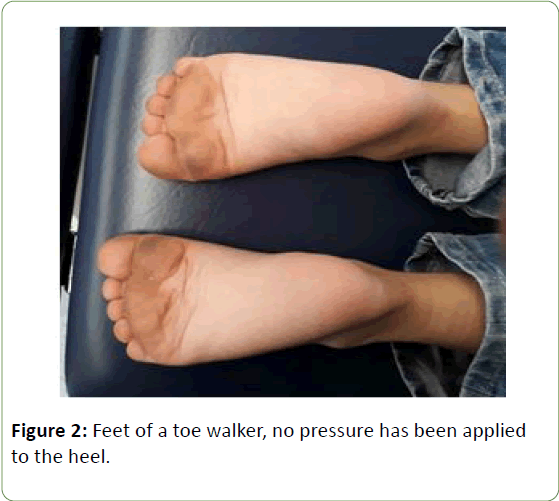 genetics-molecular-biology-toe-walker