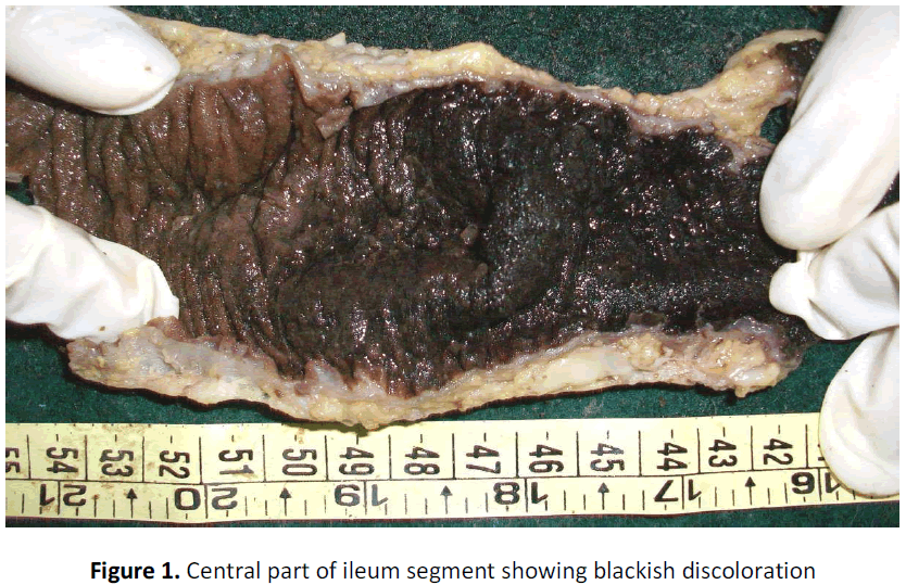 global-journal-of-research-and-review-ileum-segment-blackish