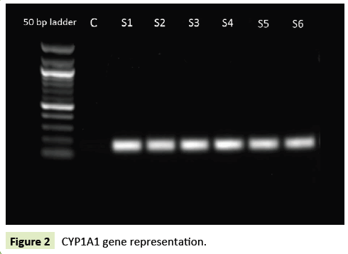 global-journal-of-research-and-review-representation