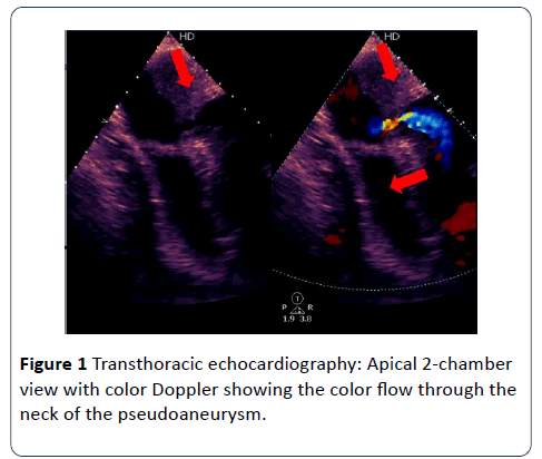 heart-and-cardiovascular-research-echocardiography