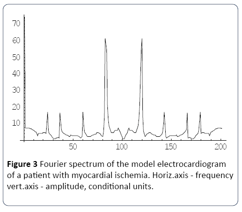 heart-and-cardiovascular-research-electrocardiogram