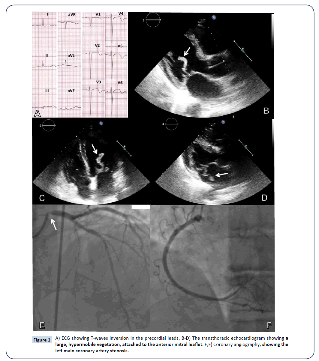 heart-and-cardiovascular-research-inversion