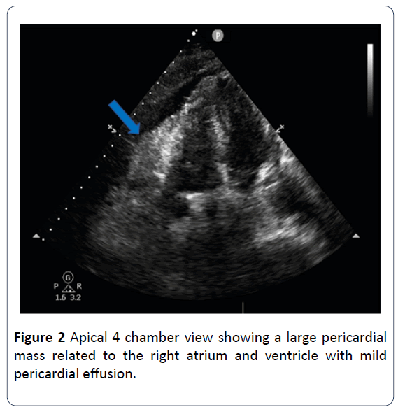 heart-cardiovascular-research-apical-chamber-view