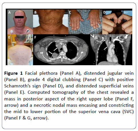 heart-cardiovascular-research-facial-plethora