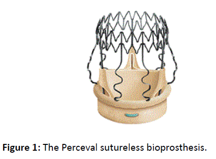 heart-health-circulation-perceval-sutureless-bioprosthesis