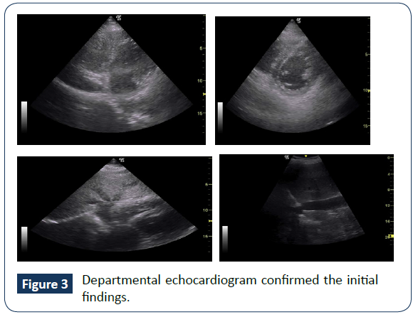 hospital-medical-management-echocardiogram