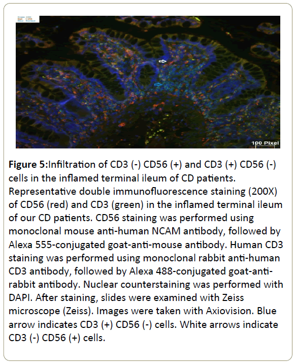 immunology-immunotherapy-anti-human-NCAM