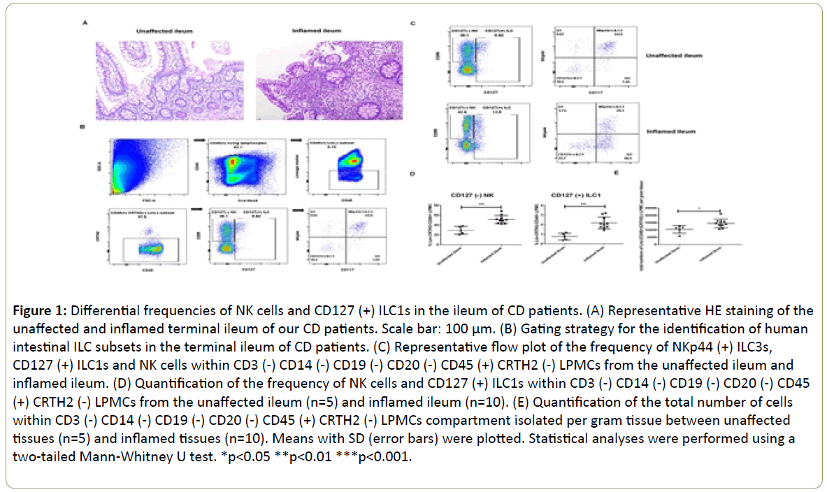 immunology-immunotherapy-frequencies-NK-cells