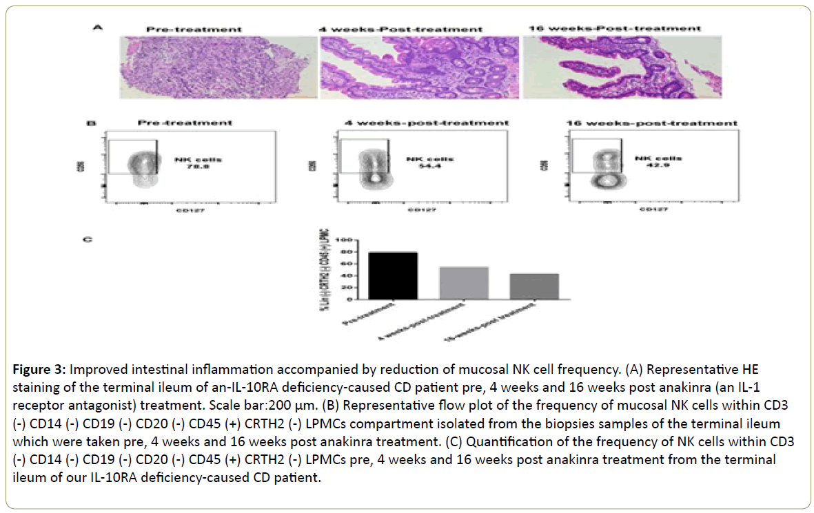 immunology-immunotherapy-intestinal-inflammation-accompanied