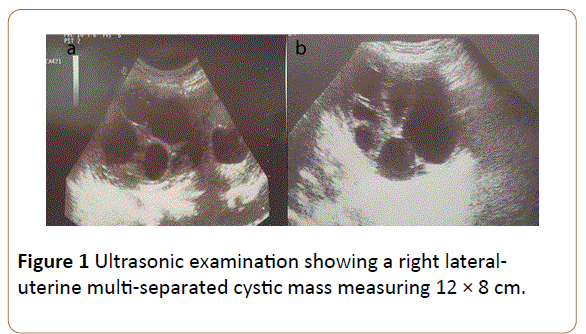 insights-in-reproductive-medicine-Ultrasonic-examination